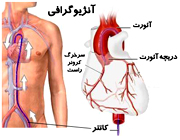 قلب